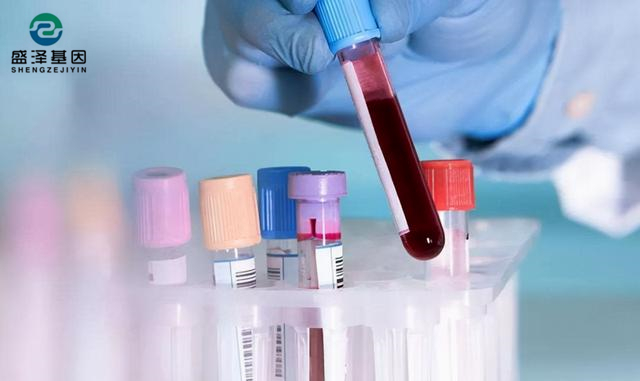 做親子鑒定父母都要驗血嗎？鑒定親子關系流程有哪些？