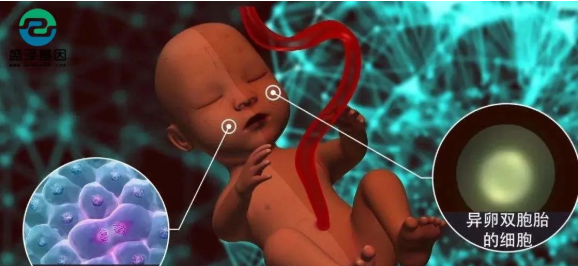 醫(yī)學(xué)怪病奇美拉現(xiàn)象:親自生未必是親生?你身體還住著另一個(gè)人? 醫(yī)學(xué)怪病奇美拉現(xiàn)象:親自生未必是親生?你身體還住著另一個(gè)人?