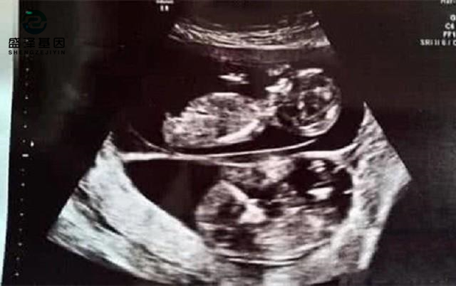 廣東男子做親子鑒定,竟發(fā)現(xiàn)自家雙胞胎有一個不是自己的?! 廣東男子做親子鑒定,竟發(fā)現(xiàn)自家雙胞胎有一個不是自己的?!