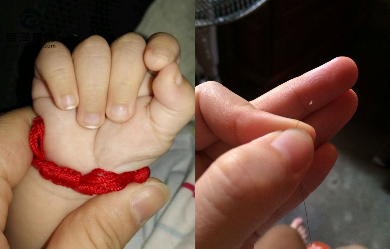 親子鑒定樣本怎么采集？采集頭發(fā)