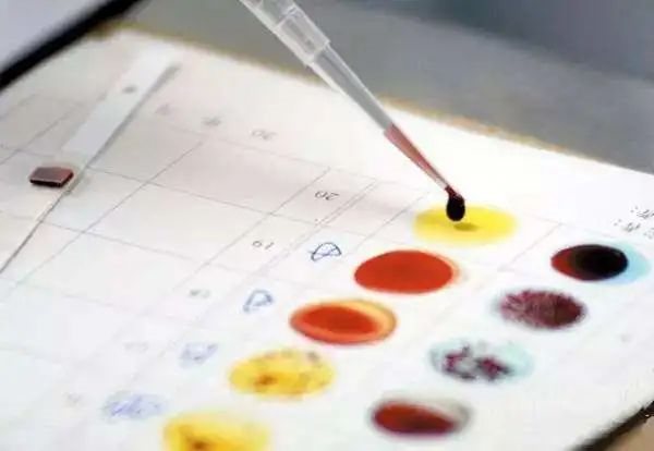 親子鑒定一般會有血型測試、染色體多態性、DNA鑒定這幾種方法