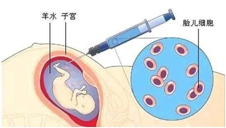無創(chuàng)胎兒親子鑒定、羊水親子鑒定、毛發(fā)親子鑒定分別怎么做？