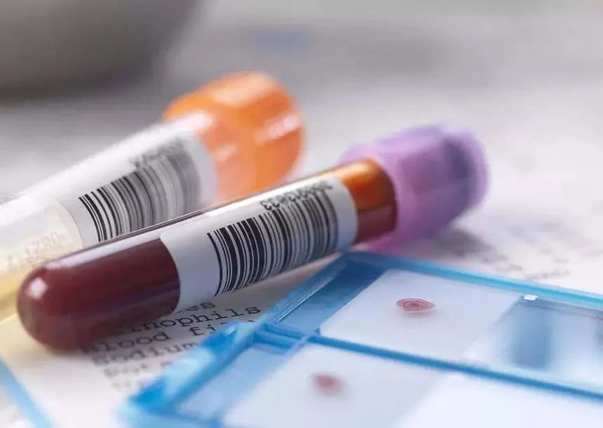 親子鑒定和血型有關系嗎？給孩子做親子鑒定需要什么樣本？