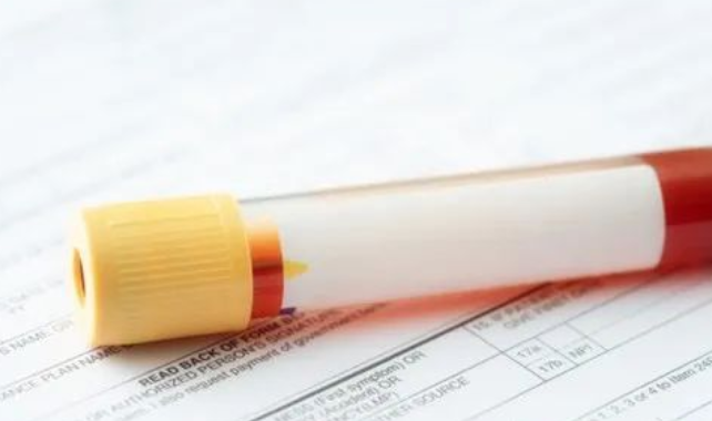 懷孕多久可以做無創胎兒親子鑒定樣本采集？