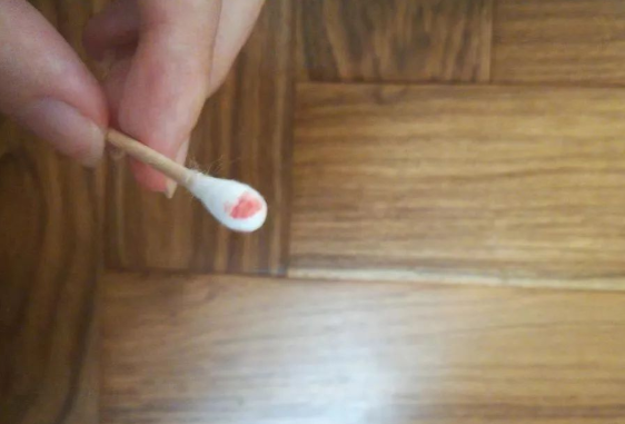 煙頭、血痕、毛發,做親子鑒定用哪些樣本最為準確? 煙頭、血痕、毛發,做親子鑒定用哪些樣本最為準確?