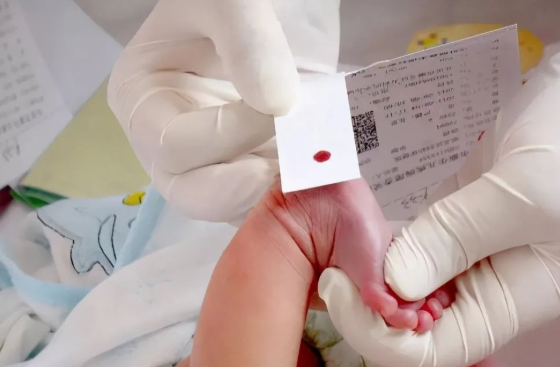 孩子出生前與出生后做親子鑒定檢測堿基有什么不同？