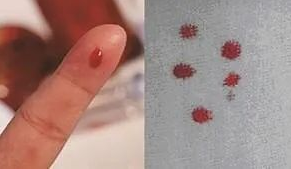 想帶小孩去做親子鑒定該如何取證呢？用紗布或棉簽等采集樣本