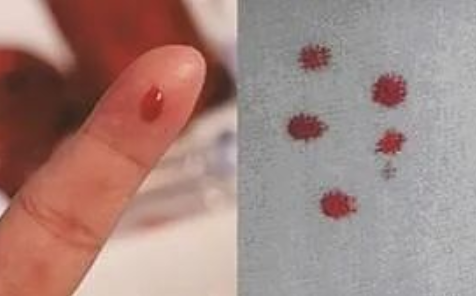 匿名親子鑒定需要準備什么?親子鑒定工作人員采樣本流程有哪些? 匿名親子鑒定需要準備什么?親子鑒定工作人員采樣本流程有哪些?