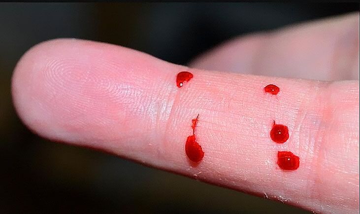 中山東升鎮能不能做親緣親子鑒定？東升鎮姐弟怎么做親子鑒定