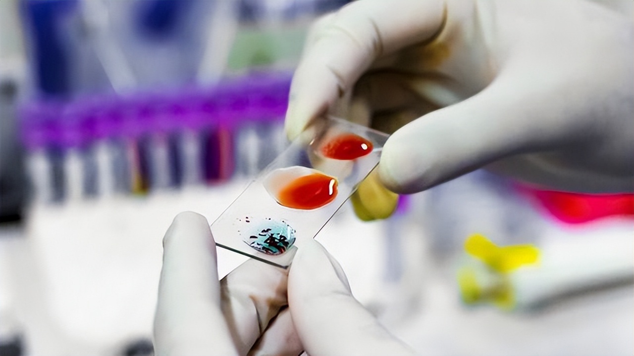 怎么用頭發做中山dna個人隱私親子鑒定？