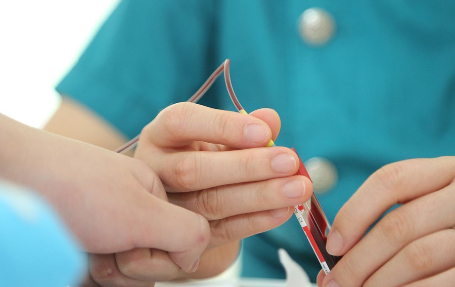 中山做親子鑒定口腔拭子樣本介紹