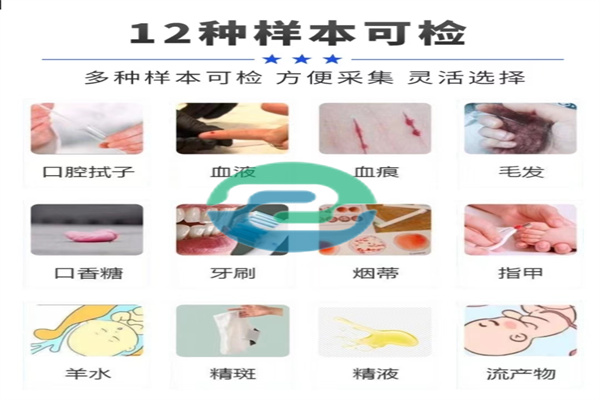 中山親子鑒定中頭發(fā)的取樣方法是什么？