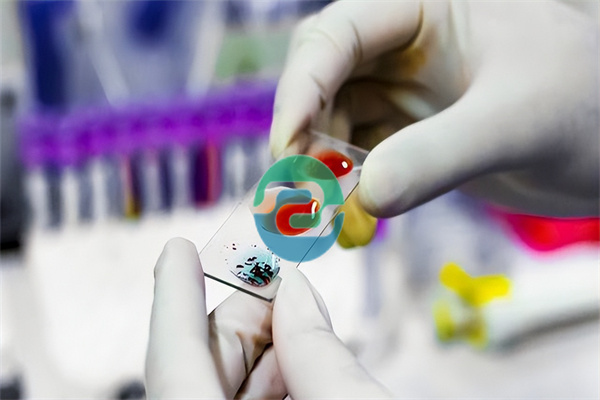 中山親子鑒定方法主要分為直接法和間接法兩大類